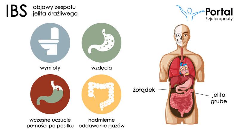 Jakie są objawy zespołu jelita drażliwego (IBS) i jak je rozpoznać?
